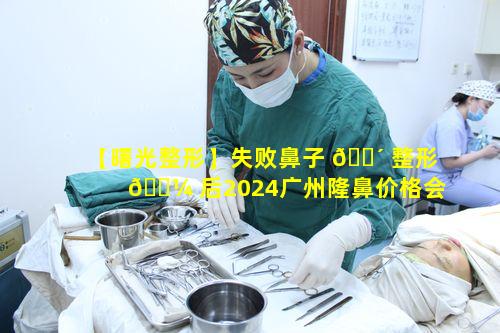 【曙光整形】失败鼻子 🌴 整形 🌼 后2024广州隆鼻价格会受影响吗